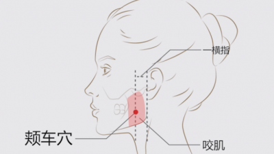 교근 massetter에 해당하는 혈자리