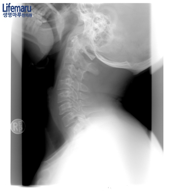 7f022cddd43e075ddff7d7286ccdc3a4513f1a1ej314.png